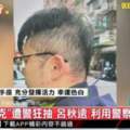 超商男子遇警痛洗12下！警棍暴行血流成河，台灣警界黑面光照引爭議