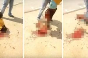 【視頻】6歲男童過馬路時被卡車碾爆雙腿，腿上「只剩一層皮」讓人眼都哭紅了！