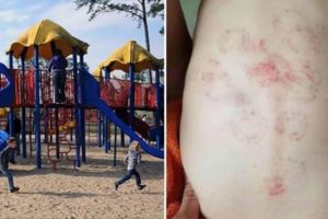 媽媽給上幼稚園的兒子洗澡，脫下上衣後竟然在他的背上發現了15個恐怖咬痕！