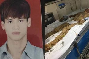 遭高溫水燙傷98％成「乾屍」母心碎：我兒才24歲阿！