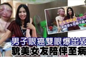 男子眼癌雙眼爆出毀容貌美女友陪伴至病逝