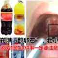 男童喉嚨布滿「鵝卵石」，壯小伙離世！夏天到了，人人都愛犯的這件事一定要注意！