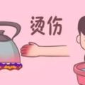 孩子燙傷後，最佳治療時間只有2分鐘，你知道該怎麼做嗎