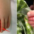 2歲兒子腳進「蟲」嚇壞寶媽，醫生看了說：再晚來一會就要截肢了