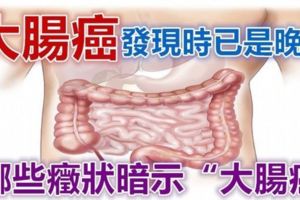 哪些癥狀暗示「大腸癌」？如果突然出現「四個癥狀」要注意，最好去醫院做檢查！！