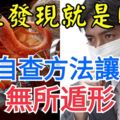 癌症發現就是晚期？9種自查方法讓癌症「無所遁形」