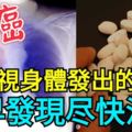 肺癌，別忽視身體發出的信號！儘早發現儘快治療