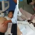 二胎媽媽剖腹產下6胞胎，出動20名醫生，看到性別後，醫生笑了！！