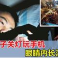 關燈玩手機至深夜，26歲男子眼內長滿結石！醫生嚴重警告！