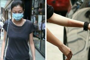 成龍女兒小龍女已出院回家，手腕幾十條自殘傷痕觸目驚心