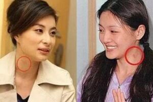 激情過度「留吻痕」的6位女星，而最後一個未婚也有？太尷尬……