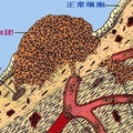 請多喝熱開水：因為癌像感冒一樣普遍： 日本新發現殺癌細胞的方法，原來就是常喝這個！