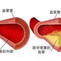 熬夜讓人變笨、變醜、死得早 比熬夜更要命的事，你每天都在做！