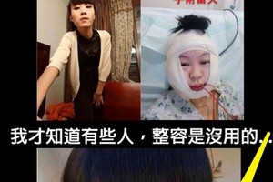 男友嫌我不漂亮要我去整容！看到這個讓我相信，有些人，整容是沒用的...