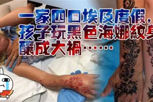 一家四口埃及度假，孩子玩黑色海娜紋身，釀成大禍（組圖）