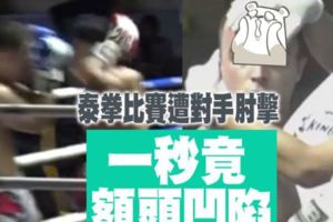 泰拳比賽遭對手肘擊　一秒竟額頭凹陷