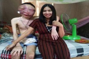 泰國21歲小伙患罕見怪病毀容，漂亮女友對他不離不棄