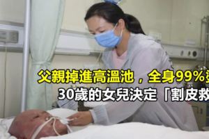 父親掉進高溫池，全身99%燙傷，30歲的女兒決定「割皮救父」