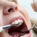 為什麼要提倡定期洗牙？