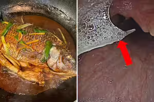 魚刺卡喉嚨「喝醋吞飯」！29歲男吐血亡　醫教正確步驟：不能拖