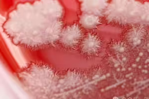 感冒秒吞抗生素!36歲男喉嚨痛 一照「長滿雪花」醫嚇愣 感冒秒吞抗生素!36歲男喉嚨痛 一照「長滿雪花」醫嚇愣