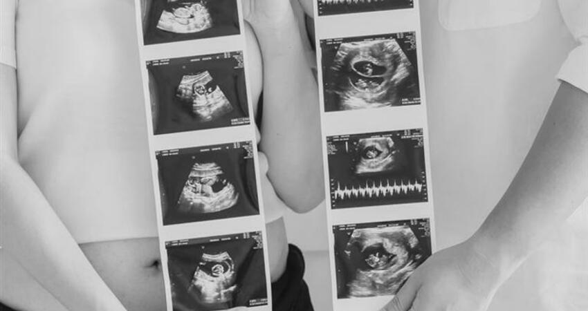 台56萬粉YTR悲痛發聲！雙胞胎女兒「還未滿月」…隔11天相繼離世