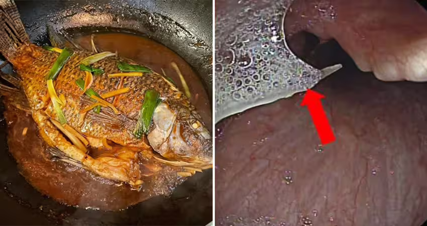 魚刺卡喉嚨「喝醋吞飯」！29歲男吐血亡　醫教正確步驟：不能拖