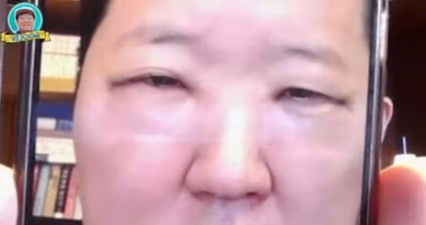 認了整形！韓男星術後「眼睛只剩一條縫」　慘認不出本人