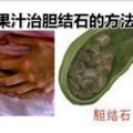 介紹蘋果汁治膽結石的方法膽結石的治療方法主要有：、保守治療、非手術治療等