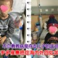 4歲男孩與腫瘤抗爭3年來瘦成皮包骨浙大兒院助其營養接力