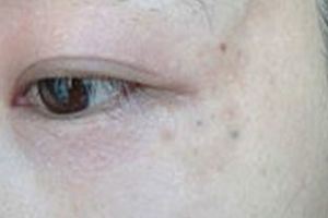 婦科病是最藏不住的病，你一得婦科病，臉就會「出賣」你