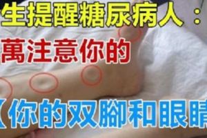 醫生提醒「糖尿病人」：如果你的腳和眼出現這些癥狀，併發症要來了！千萬注意！