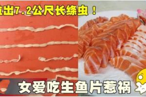 拉出7.2公尺長絛蟲！女愛吃生魚片惹禍!