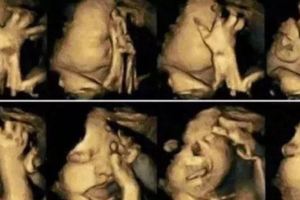 孕婦做彩超胎兒不停做鬼臉，孕婦誇孩子是天才，醫生：打掉吧