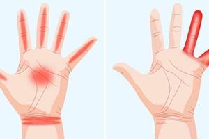 7種手痛的感覺代表身體已經在發出健康警訊，如果你以為沒什麼事那就糟了！