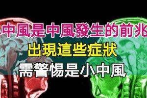 小中風是中風發生的前兆？出現這些癥狀，需警惕是小中風