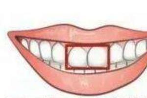 心理測試：你的門牙是哪種？測你是不是天生富貴命