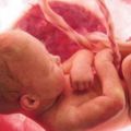 少女墮胎「孩子的頭被醫生夾斷」身體還在蠕動！護理師曝光婦產科惡夢：「還有更慘的」！