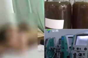 男子三餐都外食而且一定會點肉吃，結果劇痛送去醫院「醫生抽出黑血2瓶」嚇傻了！