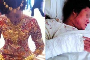 我結婚那天，母親竟然「當場割腕自殺」，沒想到老公冷漠拋下「要死出去死」！當場揭開這殘酷的事實