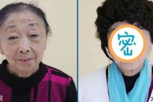 這71歲阿嬤為了嫁給37歲年輕帥哥，傾盡家產「整容成17歲少女」，如今的她變成「這個樣子」