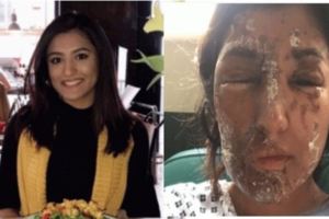 這名年輕正妹開車停紅燈，被陌生男子「澆淋強酸腐蝕液」，沒想到術後就像浴火重生的鳳凰#4顏值美到冒泡！！！