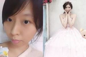 28歲「癌末的她」為圓夢忍痛上陽明山拍「一個人的婚紗」，連外媒也被她的勇氣感動，登上《BBC》！