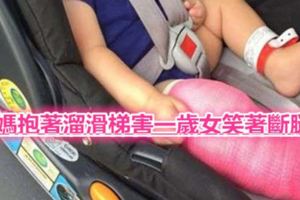 媽抱著溜滑梯害一歲女笑著斷腿