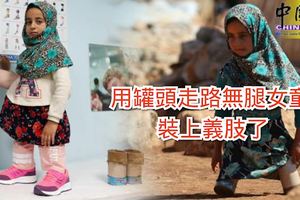 用罐頭走路無腿女童裝上義肢了