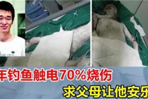 26歲青年釣魚觸電，全身燒傷70%，求父母，讓他安樂死