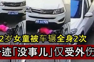 2歲女童被車輾全身2次奇跡「沒事兒」僅受外傷