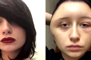 正妹染髮變異形！毀容慘變「燈泡頭」瀕死真相嚇壞