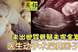 悲！未出世嬰脊髓未完全發育醫生動手術後塞回子宮！