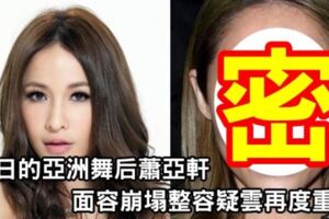 39歲天後蕭亞軒整容崩顏，整容疑雲再度重現，你還認得出她是誰嗎？